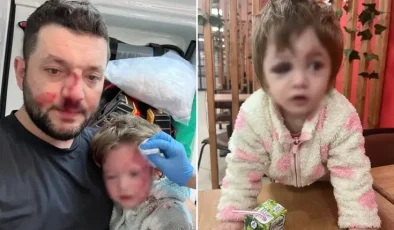 İşte 14 aylık İkra bebeği hastanelik edenlere istenen ceza! Skuter silah sayıldı